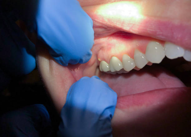 Best Pediatric Emergency Dentist in Sweetwater, TX